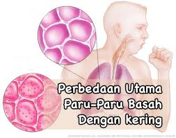 Illustration for article titled Jenis Penyakit Paru Paru Dan Gejalanya